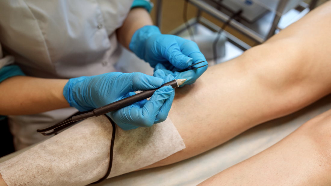 Еволюція гладкості, або Чому електрика — найкращий ворог волосини